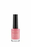 Note Nail Flawless Oje 80 Confetti Candy - Pembe
